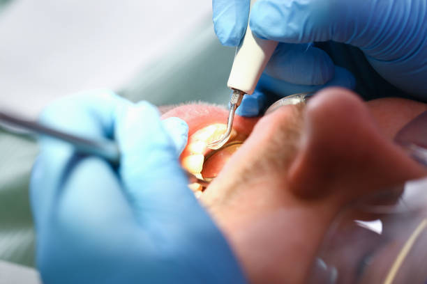Best Mobile Emergency Dentist in Hiram, GA