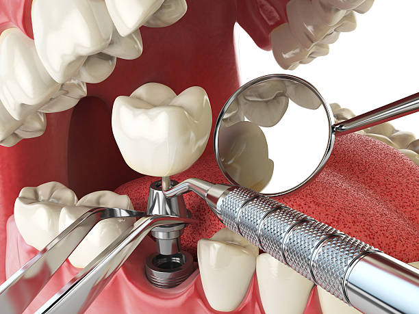 Best Emergency Cosmetic Dentistry in Hiram, GA