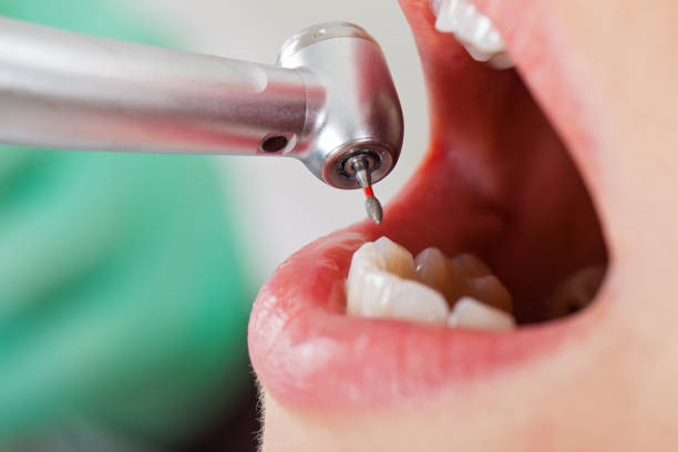 Best Pediatric Emergency Dentist in Hiram, GA